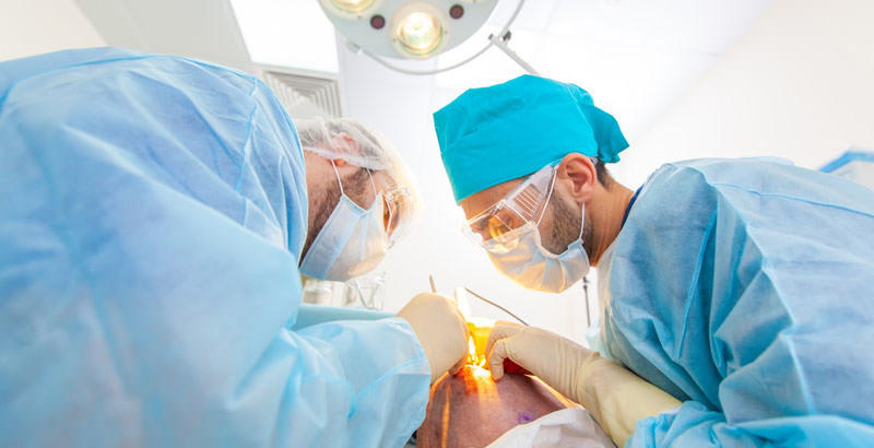 Cirujanos durante un trasplante capilar